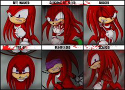 Size: 900x649 | Tagged: semi-grimdark, artist:violet-tarita, knuckles the echidna, echidna, 2013, abstract background, bite mark, bleeding from mouth, blindfold, blood, bondage, bruise, chains, character abuse, character abuse meme, coughing, coughing up blood, english text, knuckles abuse, meme, one eye closed, panels, scar, sitting, solo, standing