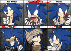 Size: 900x649 | Tagged: semi-grimdark, artist:unichrome-uni, sonic the hedgehog, hedgehog, 2013, abstract background, ambiguous gender, bite mark, blindfold, blood, bondage, bruise, character abuse, character abuse meme, coughing, coughing up blood, crying, duo, frown, gloves, looking at viewer, looking offscreen, male, meme, modern sonic, mouth open, nosebleed, scar, sitting, sonic abuse, standing, tape, tears of shock