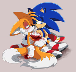 Size: 2100x1991 | Tagged: semi-grimdark, artist:montyth, miles "tails" prower, sonic the hedgehog, 2023, beige background, bleeding, bleeding from mouth, blood, blood stain, bruise, commission, crying, duo, frown, holding them, imminent death, injured, lidded eyes, looking at each other, one eye closed, sad, simple background, smile, tears, tears of sadness